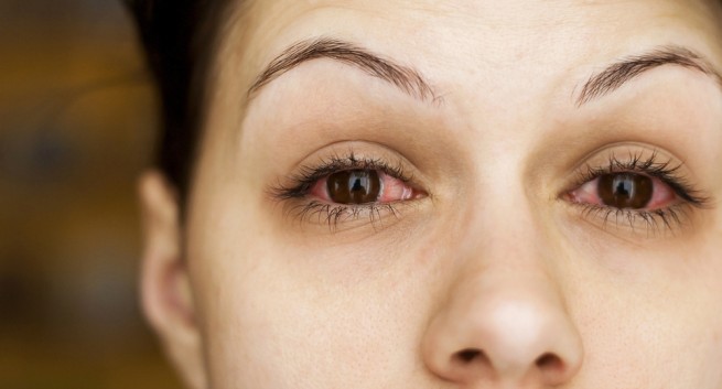 воспаление слизистой оболочки глаз