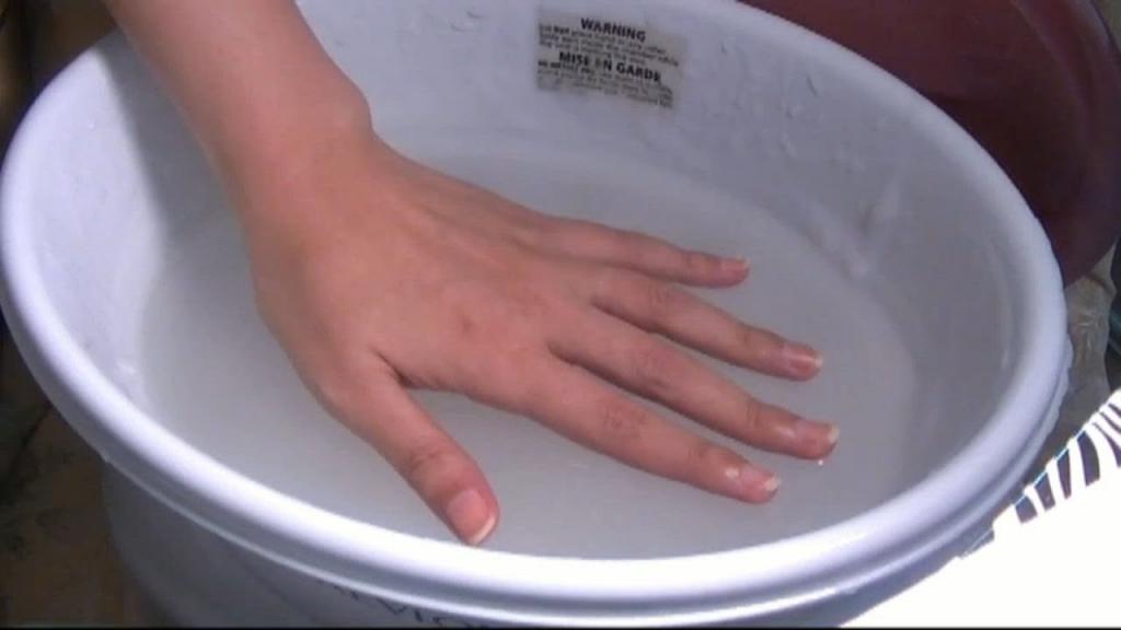 Ванночки от грибка ногтей на руках